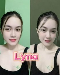 Lyna